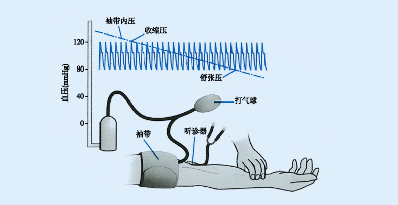 动脉血压的测量方法